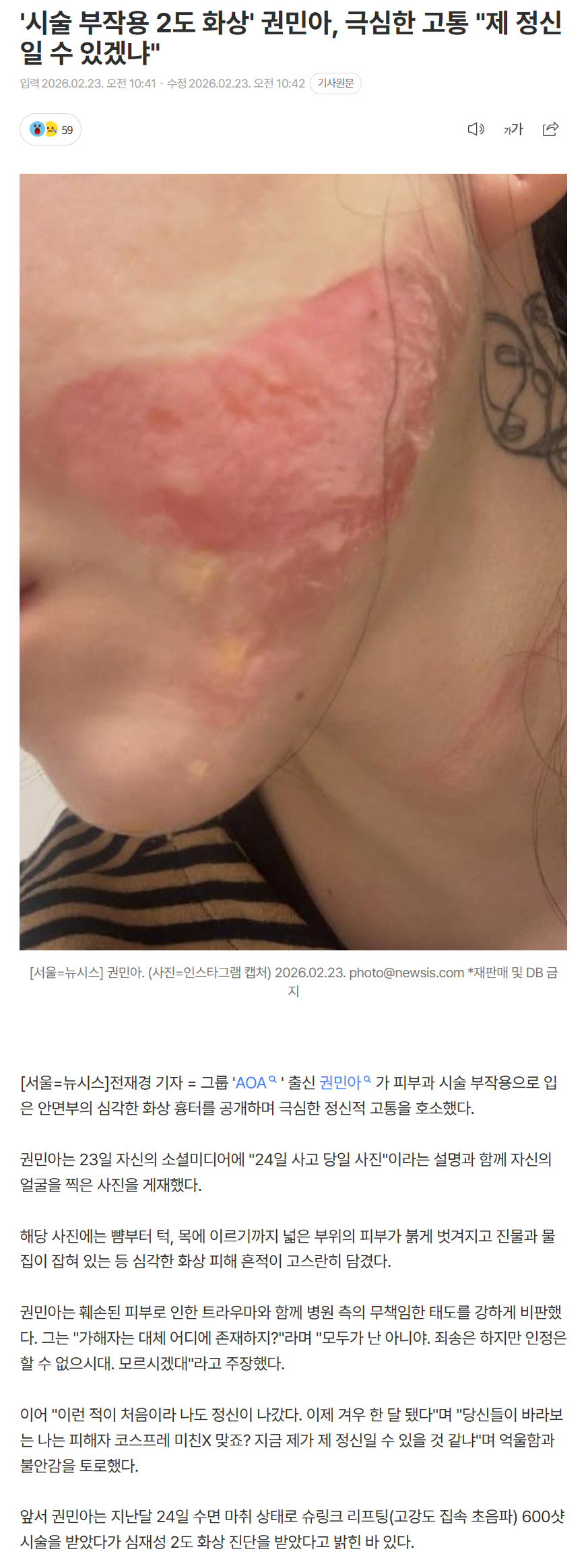 699bd4f3dce35_ (6).png